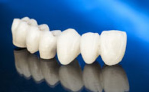 Les nouveaux matériaux utilisés pour reconstruire une dent abîmée