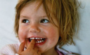 Pourquoi soigner les dents de lait des enfants ?