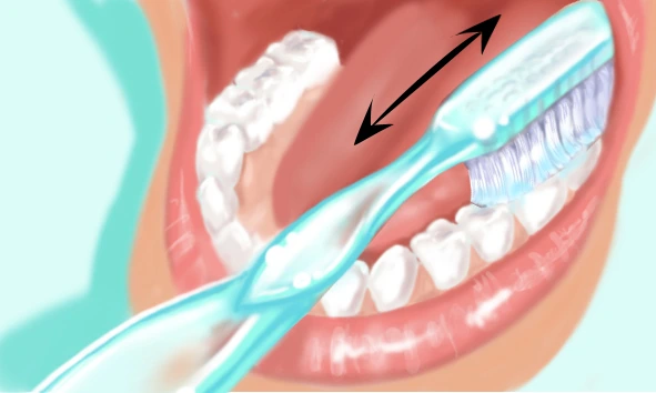 Technique brossage des dents 1
